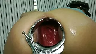 দুটি ট্র্যাশ ছুদা চু ...